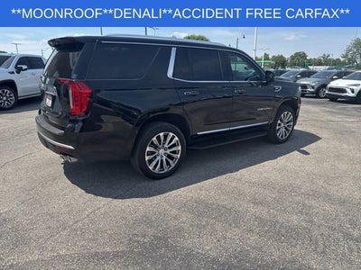 2024 GMC Yukon Denali